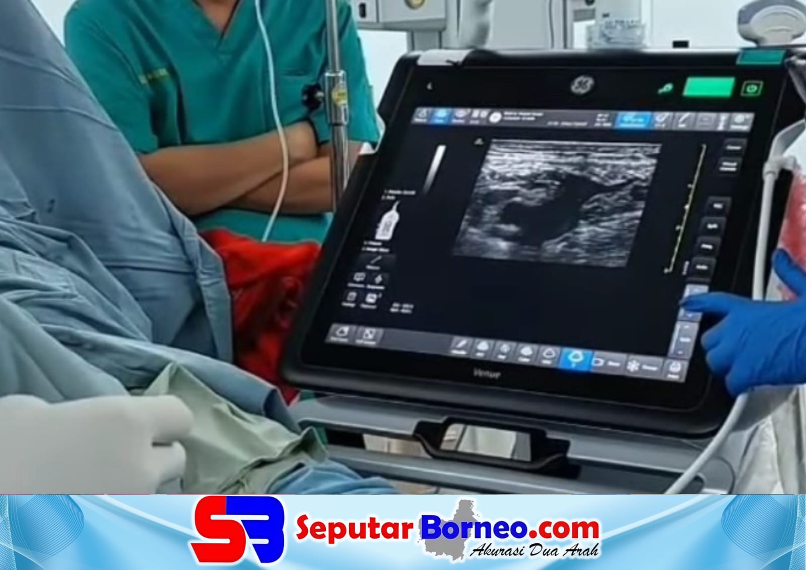 RSUD Murjani Sampit Sukses Lakukan Ablasi Vena Perdana, Pasien Bisa Pulih Lebih Cepat